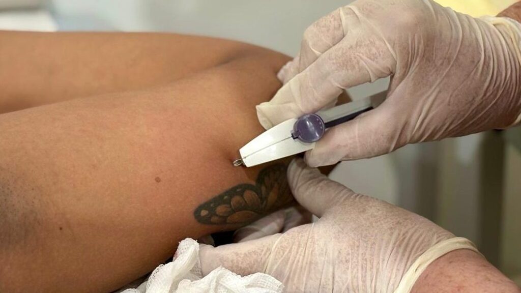 Prefeitura de Rio Branco amplia acesso ao Implanon e capacita profissionais na URAP Roney Meireles